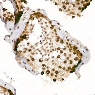 Immunohistochemistry-Paraffin: ATR [p Ser428] Antibody - Azide and BSA Free [NBP3-05447]